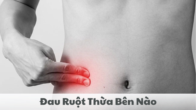 đau ruột thừa bên nào