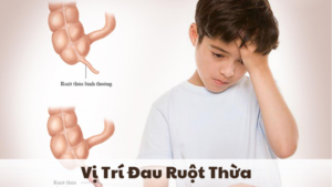 vị trí đau ruột thừa