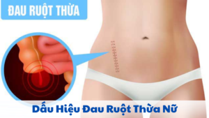 dấu hiệu đau ruột thừa nữ