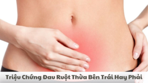 triệu chứng đau ruột thừa bên trái hay phải