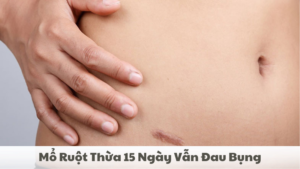 mổ ruột thừa 15 ngày vẫn đau bụng