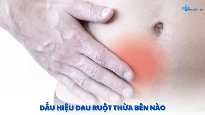 dấu hiệu đau ruột thừa bên nào