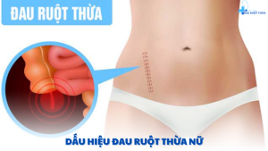 dấu hiệu đau ruột thừa nữ